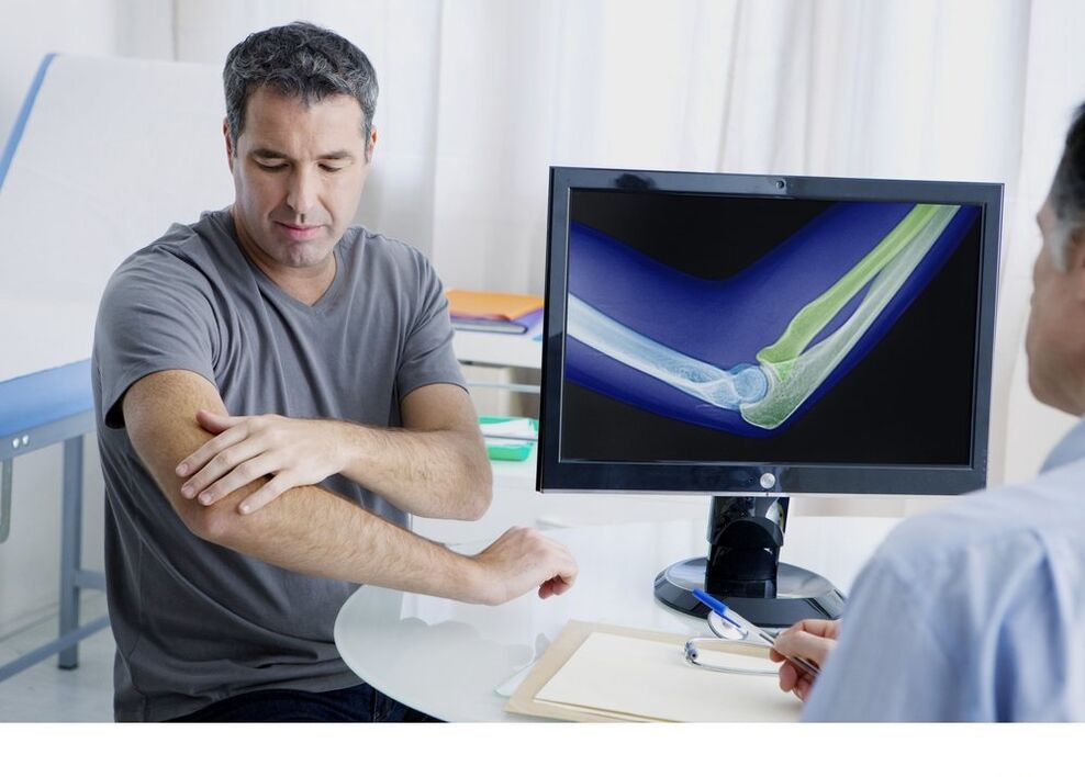 A könyökízület arthrosis az x -try képen