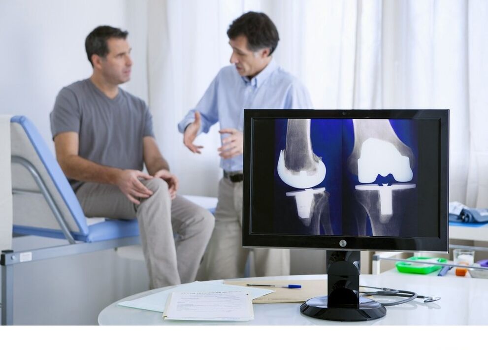 A térdízület arthrosis az x -try képen