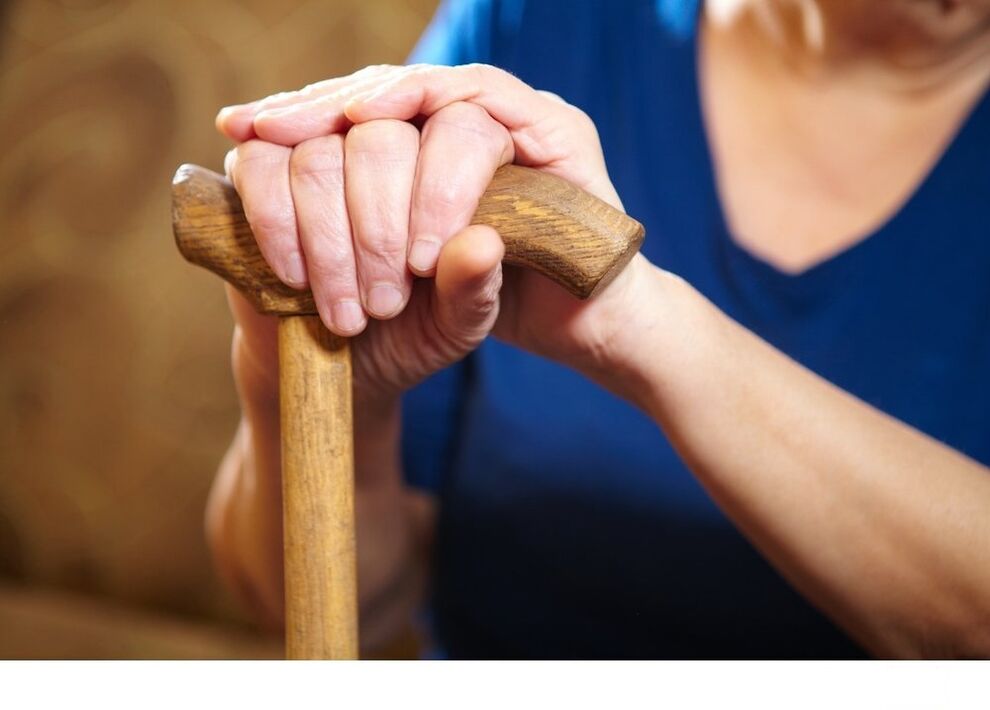 Cane használata coxarthrosishoz